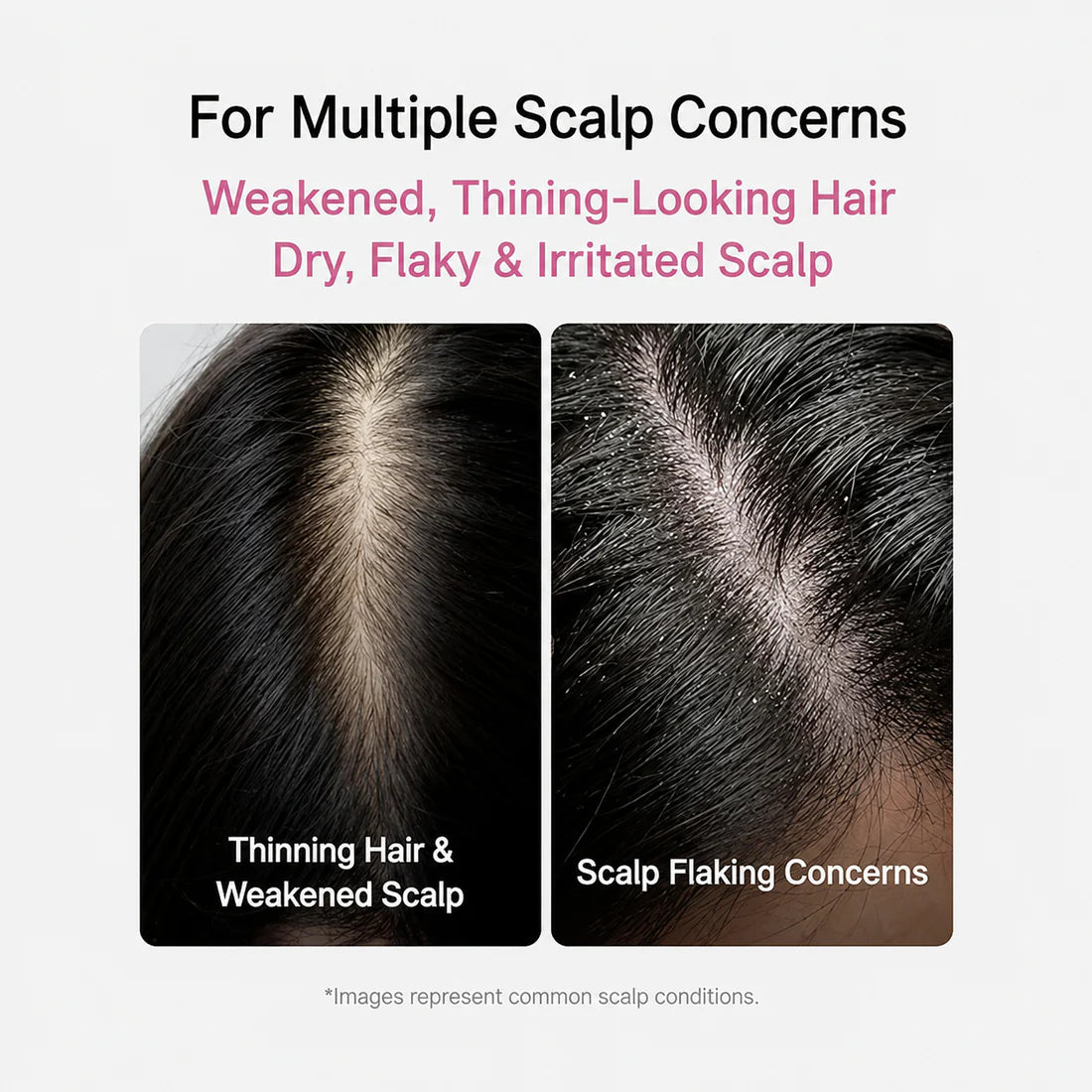Rosemary PDRN Spicule Scalp Serum